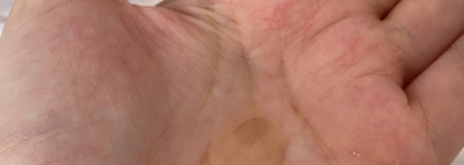 Botavikos - натуральное для жирной кожи - работает