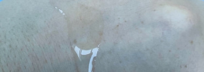 SkinpHoria Elements Mandelic Acid Peeling Serum 3% - опять пою оды кислотам