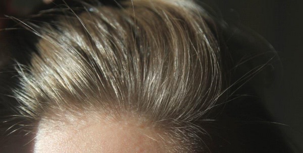 Пара приемов для волос: аромарасчесывание и стимулирование роста