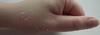 Такой разный пилинг