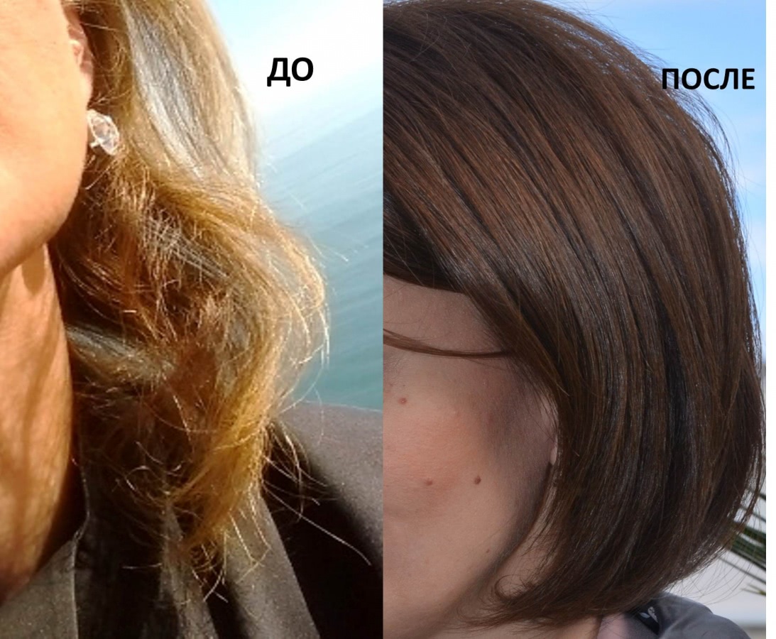 Мезо для волос до и после фото