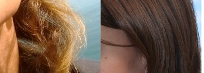 Продолжение следует или уход за волосами после мезотерапии