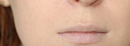 Shiseido Synchro Skin #Rose 1