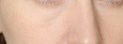 Shiseido Synchro Skin #Rose 1