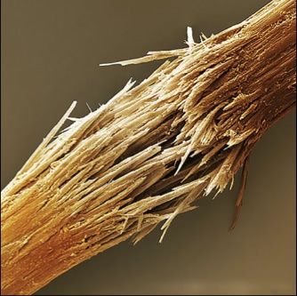 Волос Под Микроскопом Фото