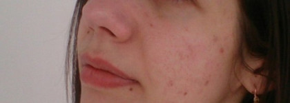 Must-have визажистов и бьюти-блоггеров. Make up for ever Face&Body - Liquid make up. Оттенок № 20 Ivory. До и После