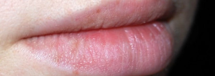 Гель для коррекции объема и формы губ от Mirra