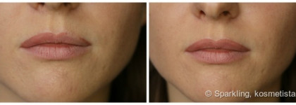 Как я делаю губы больше и пухлее