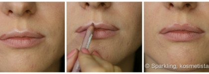 Как я делаю губы больше и пухлее