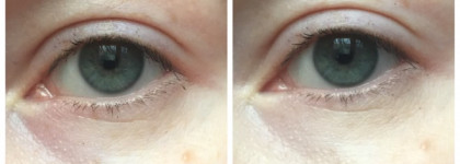 Консилеров много не бывает : Artdeco, Clarins, Lancome, YSL