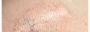 Консилеров много не бывает : Artdeco, Clarins, Lancome, YSL