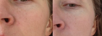 Shiseido Refining Makeup Primer SPF 20 PA+ 30g