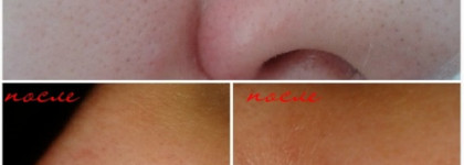 Ciracle Pore Control Blackhead Off Sheet или “Гудбай, черные точки!”