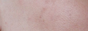 Гликолевый пилинг в домашних условиях с Reviva Labs, 10% Glycolic Acid Cream или эксперимент, длиною в месяц