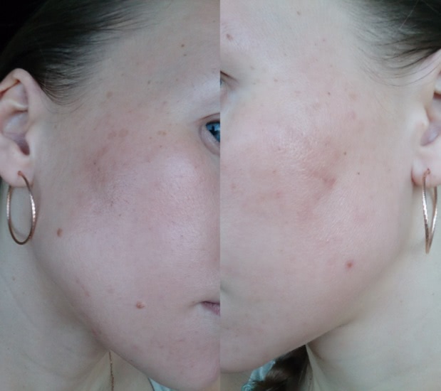 Гликолевый пилинг в домашних условиях с Reviva Labs, 10% Glycolic Acid Cream или эксперимент, длиною в месяц