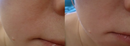 Reviva Labs, Тоник для лица с гликолевой кислотой из линейки гликолевого пилинга