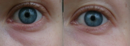 Now Solutions CO Q10 Antioxidant Serum— лифтингу быть