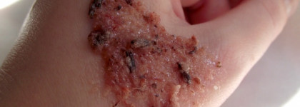 Organic Kitchen для жирной кожи: пустышка или достойные средства за копейки?