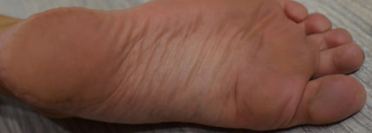 Aravia Professional "Callus Remover "- Гель Размягчяющий от натоптышей Callus Remover