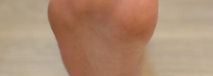 Aravia Professional "Callus Remover "- Гель Размягчяющий от натоптышей Callus Remover