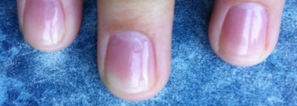 Гелевая система Essence. Прошу совета