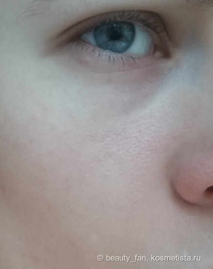 Mixit Vitamin Mask или загадочное исчезновение расширенных пор (фото до/после)