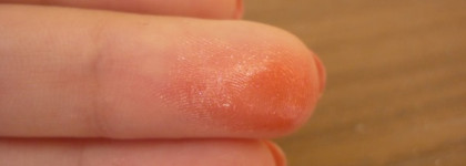 Lumene Raspberry Miracle Lip Sorbet №14 Fresh Morning