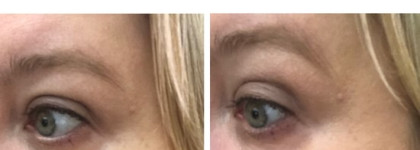 "Видишь суслика? А он есть!" Clinique ID Dramatically Different Moisturizing BB Gel & Active Cartridge Concentrate