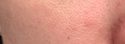 И снова мимо. Рассказ о том, как я целый год пыталась подружиться с BB кремом от Dr. Jart+ Rejuvenating Beauty Balm Silver Label SPF35