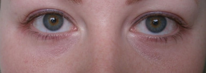 Консилеры для светлокожих - Nyx и Clarins