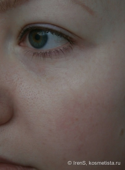 Корректирующий крем от купероза Skin Doctors Capillary Clear
