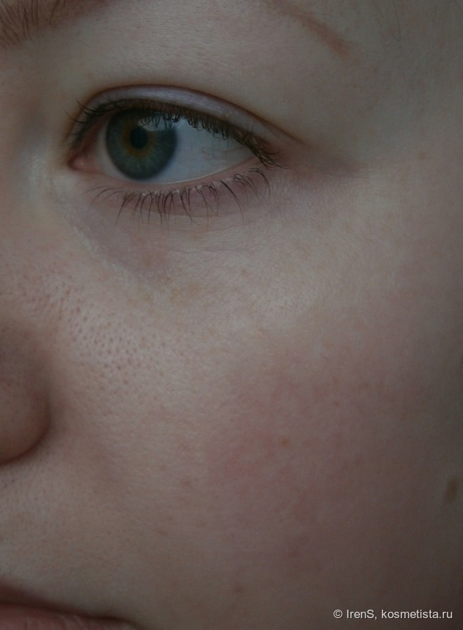 Крем для кожи лица с проявлениями купероза capillary clear отзывы thumbnail