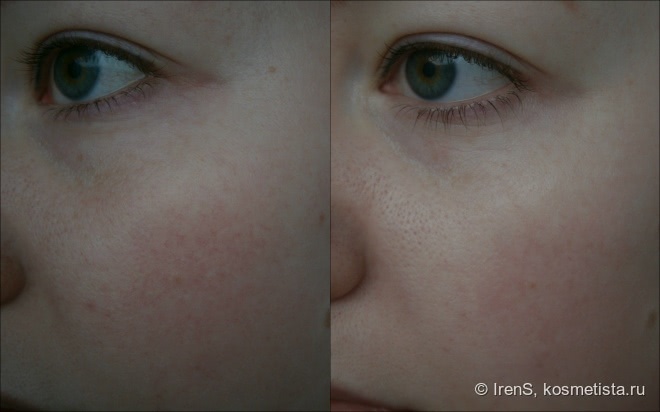 Корректирующий крем от купероза Skin Doctors Capillary Clear