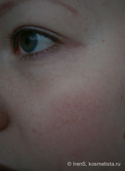 Корректирующий крем от купероза Skin Doctors Capillary Clear