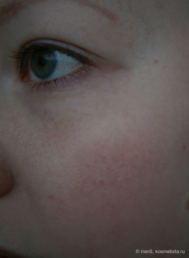 Крем для кожи лица с проявлением купероза capillary clear отзывы