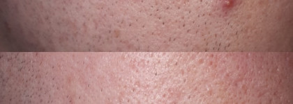 Anna Lotan Provit cream mask. Крем-маска Провит