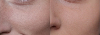 Almea Eyelash Serum Xlash