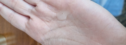 Уход за сухой кожей лица в осенний период