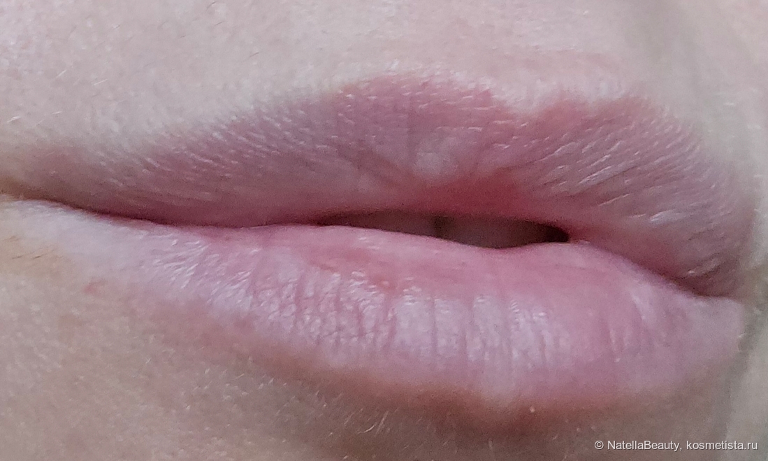 Губы до. Сухость и корочки