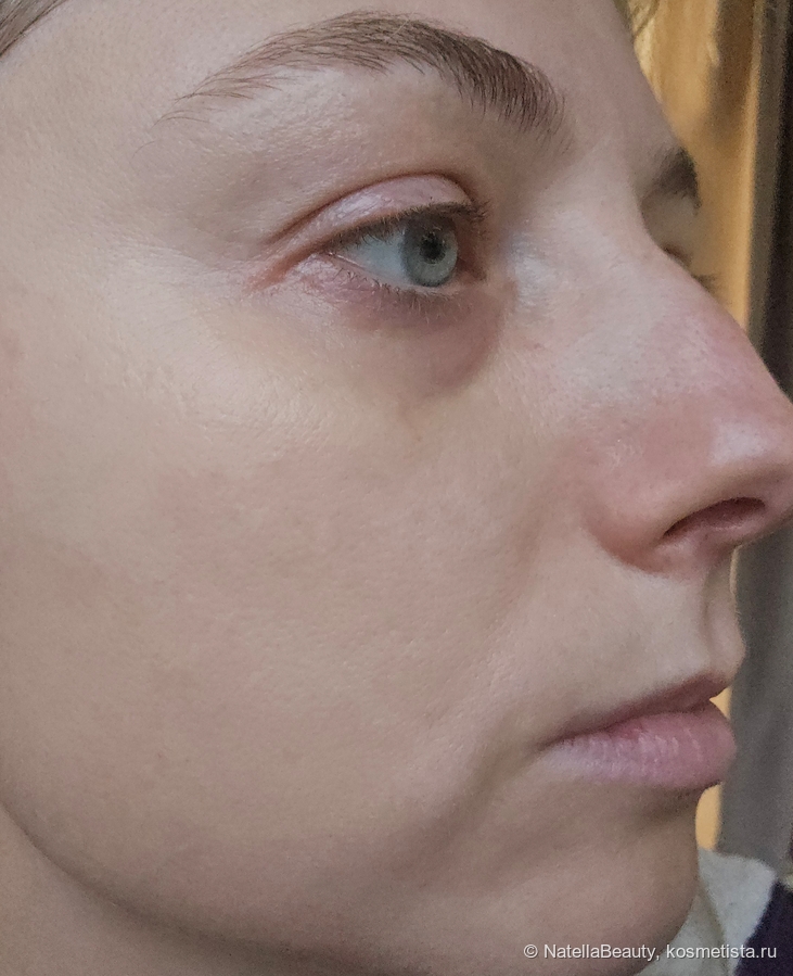 После применения