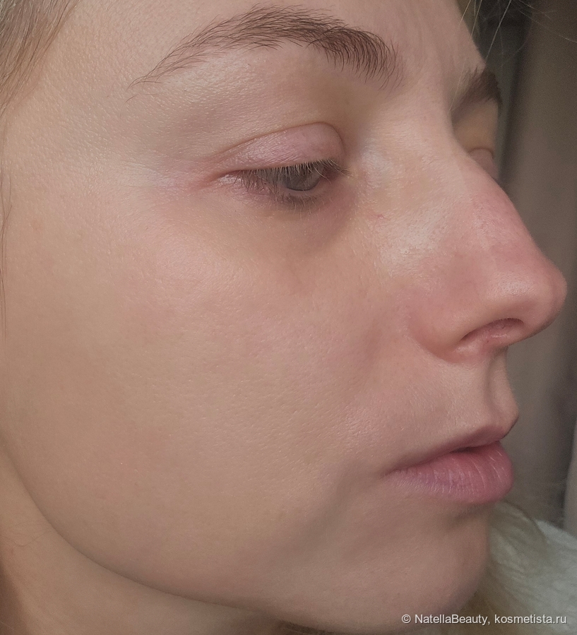 После применения