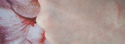 Восстановление проблемной кожи с La Roche - Posay