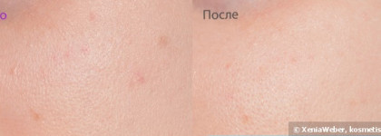 Paula’s Choice Resist Weekly Retexturizing Foaming Treatment  4% BHA