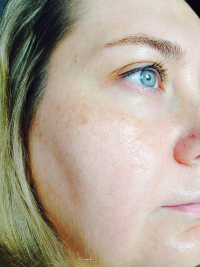 Janssen Trifolia Face Mask. Это любофф