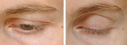 Tony Moly Brightening Eyes Base Panda's Dream: Тёмные круги, до свидания