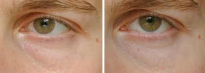 Tony Moly Brightening Eyes Base Panda's Dream: Тёмные круги, до свидания