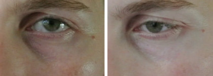 Tony Moly Brightening Eyes Base Panda's Dream: Тёмные круги, до свидания