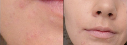 Тональный флюид Givenchy Eclat Matissime Fluid Foundation Airy-Light Mat Radiance SPF 20 — PA++, #3 Mat Sand