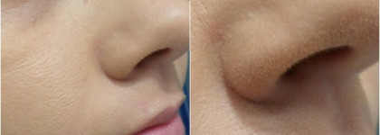 Компактная пудра «Идеальный тон» Vichy Teint Ideal Illuminating Foundation SPF 25, #2 Medium