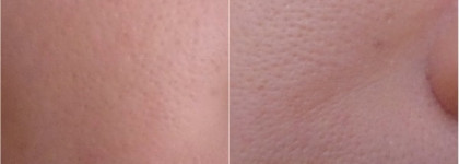 Компактная пудра «Идеальный тон» Vichy Teint Ideal Illuminating Foundation SPF 25, #2 Medium